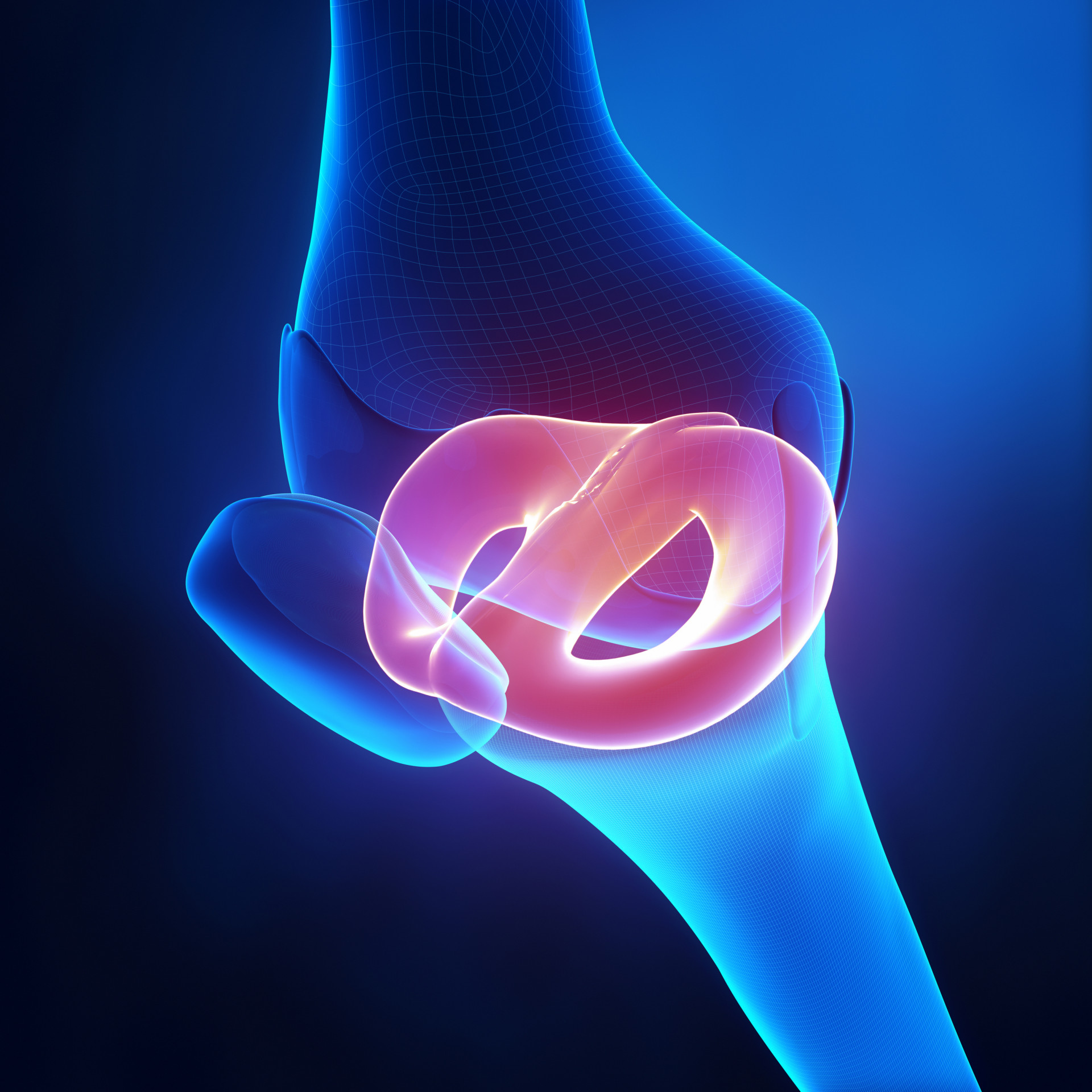 meniscus repair device