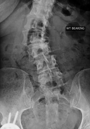 Dr. Lowe - a gifted surgeon