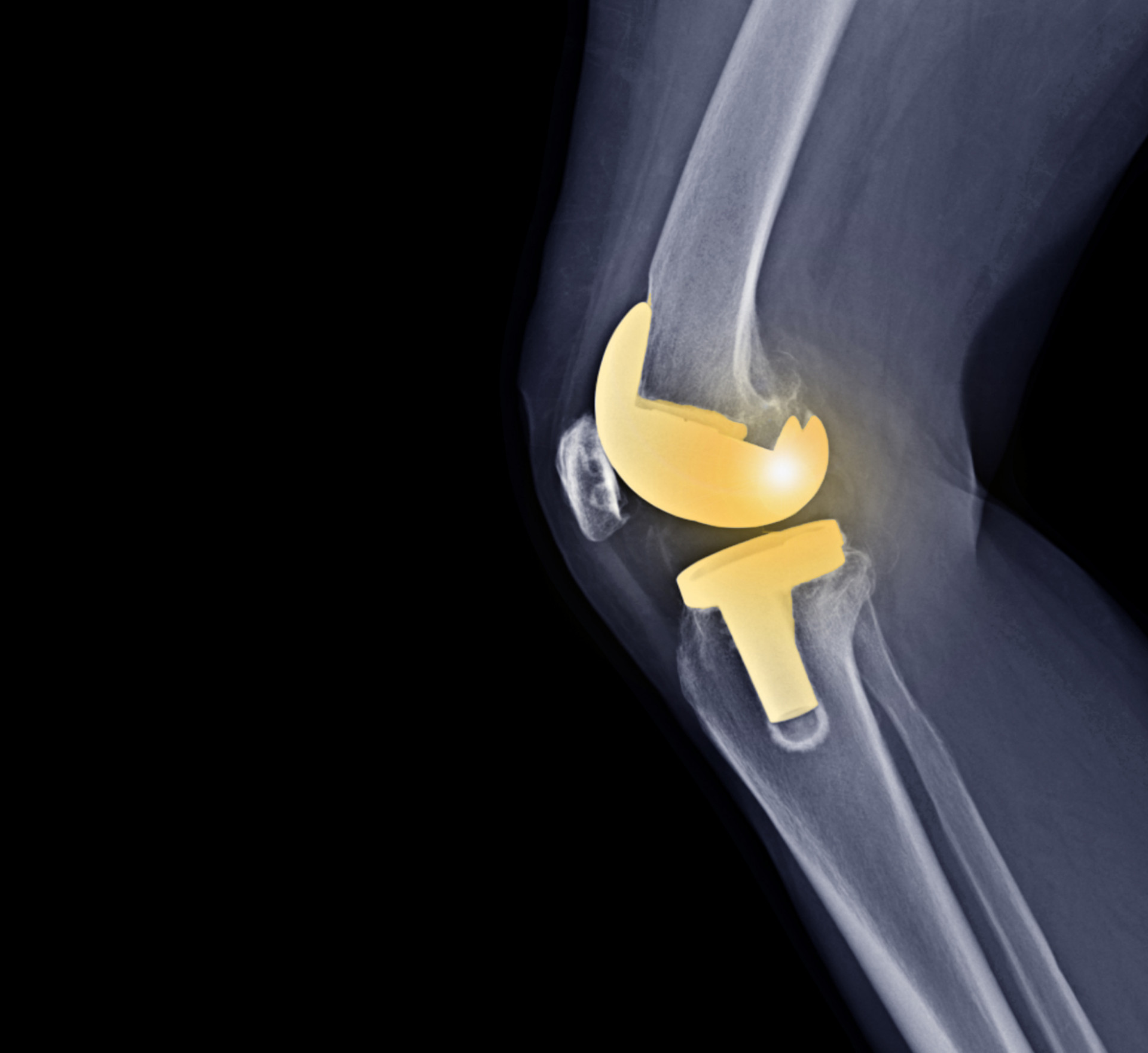 Tennessee Orthopaedic Alliance Orthopedic Urgent Care Hendersonville - 6njcr4n